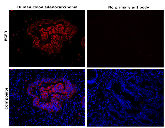 EGFR Antibody in Immunohistochemistry (Paraffin) (IHC (P))