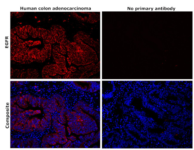 EGFR Antibody in Immunohistochemistry (Paraffin) (IHC (P))