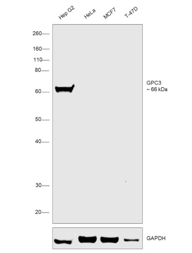 Glypican 3 Antibody