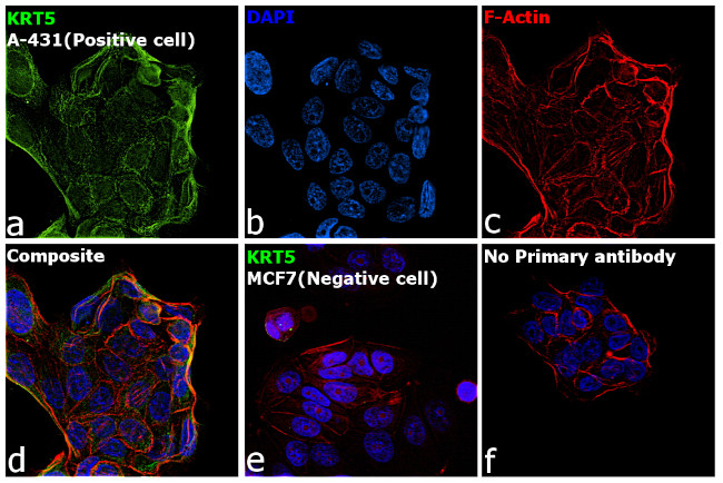 Cytokeratin 5 Antibody in Immunocytochemistry (ICC/IF)