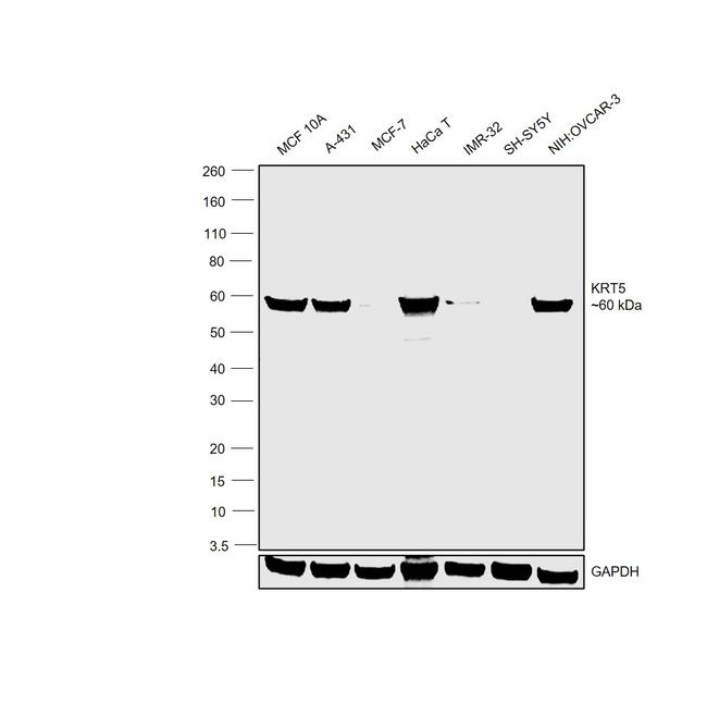 Cytokeratin 5 Antibody in Western Blot (WB)