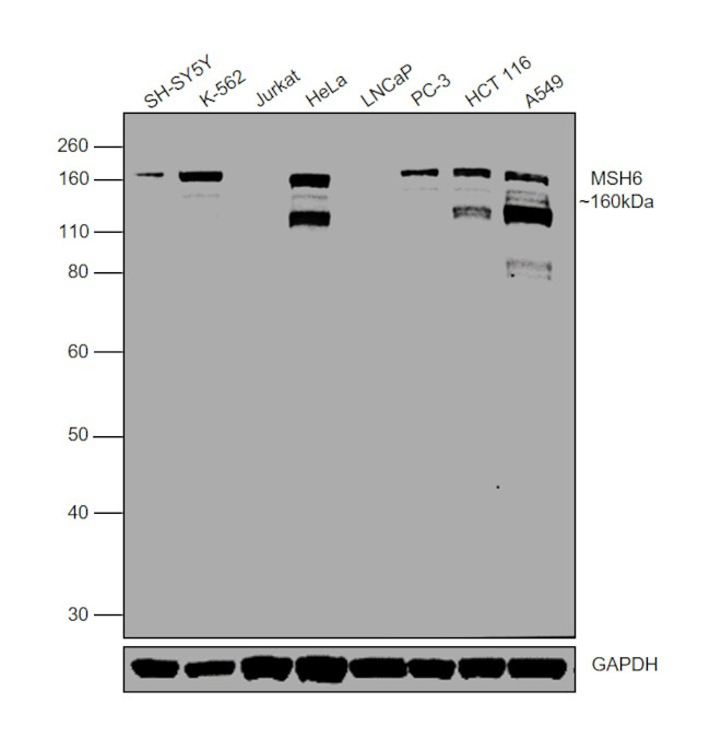 MSH6 Antibody