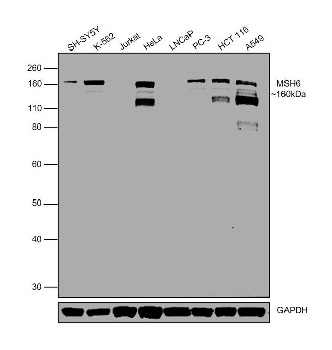 MSH6 Antibody in Western Blot (WB)