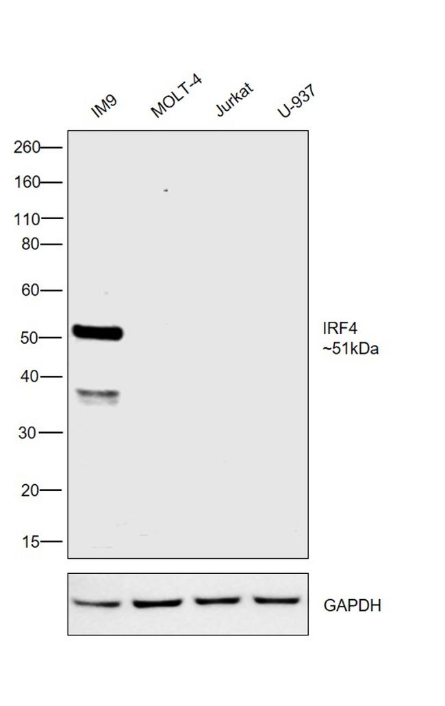 IRF4 Antibody in Western Blot (WB)