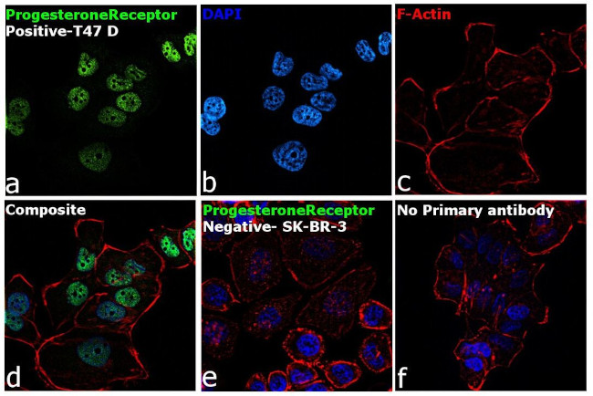 Progesterone Receptor Antibody