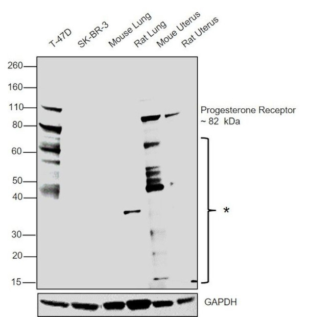 Progesterone Receptor Antibody