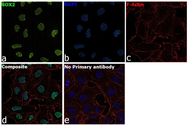 SOX2 Antibody in Immunocytochemistry (ICC/IF)