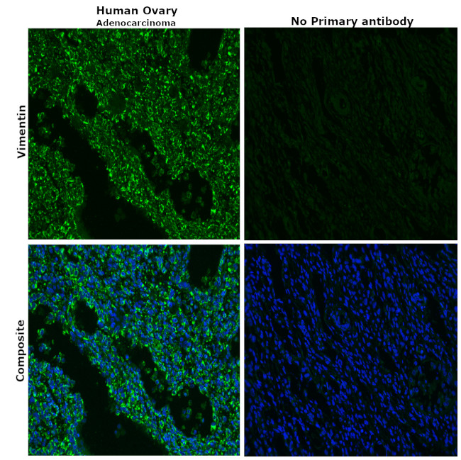 Vimentin Antibody in Immunohistochemistry (Paraffin) (IHC (P))