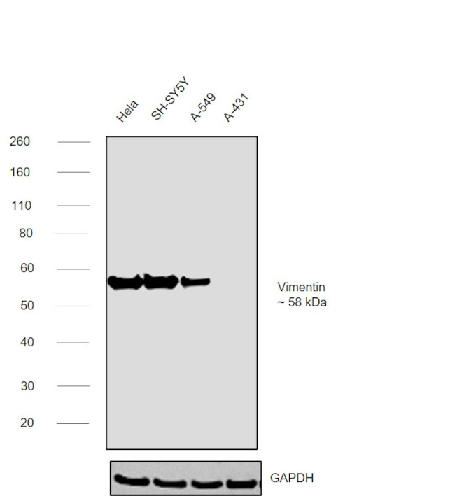 Vimentin Antibody