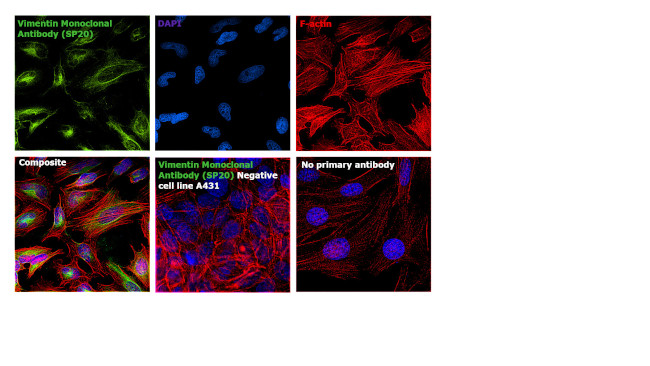 Vimentin Antibody