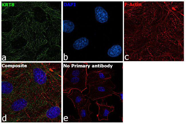 Cytokeratin 8 Antibody in Immunocytochemistry (ICC/IF)