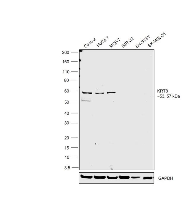 Cytokeratin 8 Antibody in Western Blot (WB)