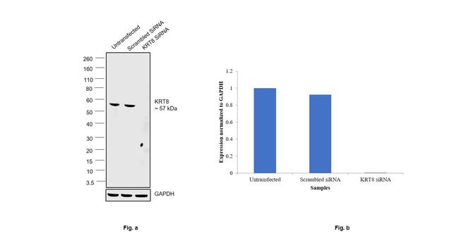 Cytokeratin 8 Antibody in Western Blot (WB)