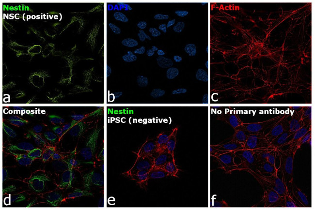 Nestin Antibody in Immunocytochemistry (ICC/IF)