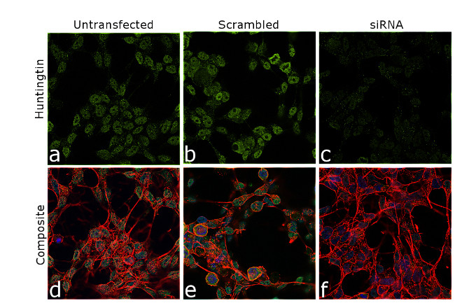 Huntingtin Antibody in Immunocytochemistry (ICC/IF)