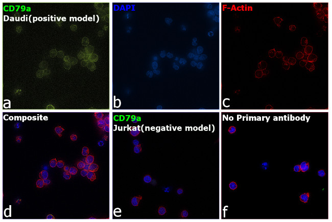 CD79a Antibody in Immunocytochemistry (ICC/IF)