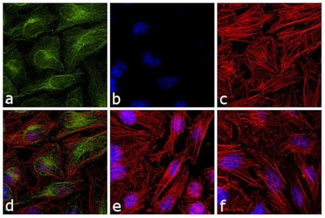 Mouse IgG1 (Heavy chain) Secondary Antibody in Immunocytochemistry (ICC/IF)