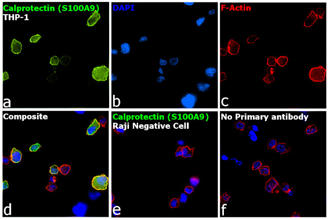 Calprotectin Antibody