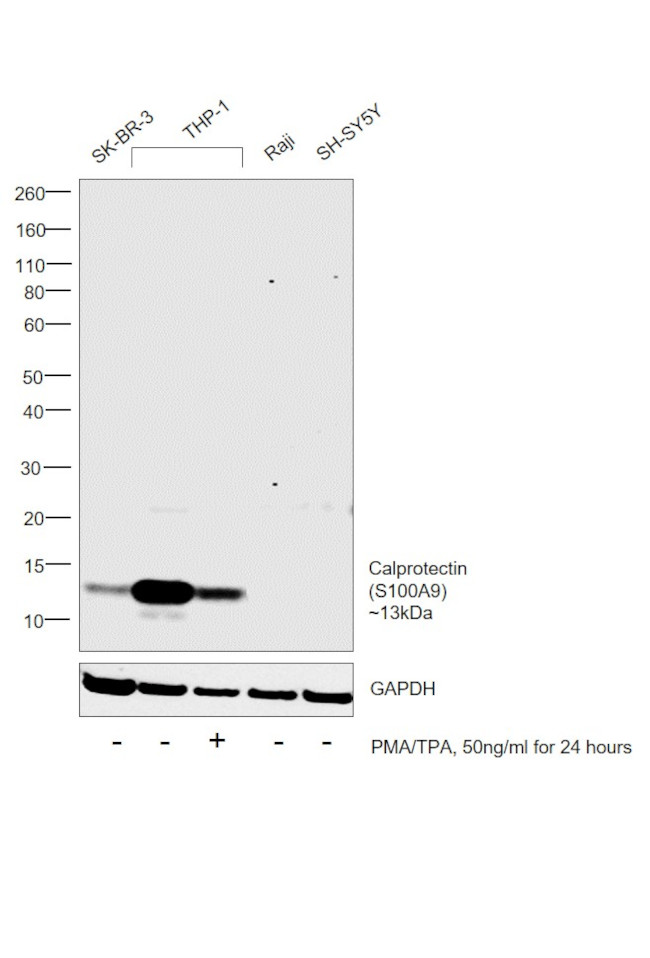 Calprotectin Antibody