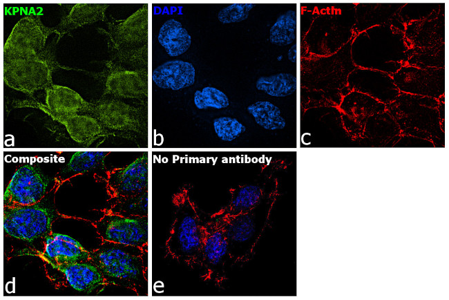 KPNA2 Antibody in Immunocytochemistry (ICC/IF)