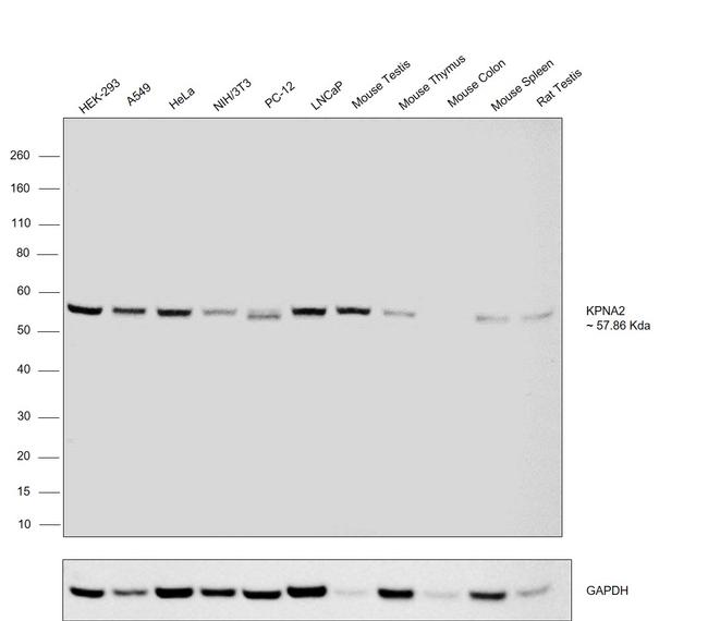 KPNA2 Antibody in Western Blot (WB)