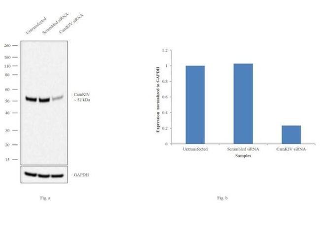 CaMKIV Antibody in Western Blot (WB)