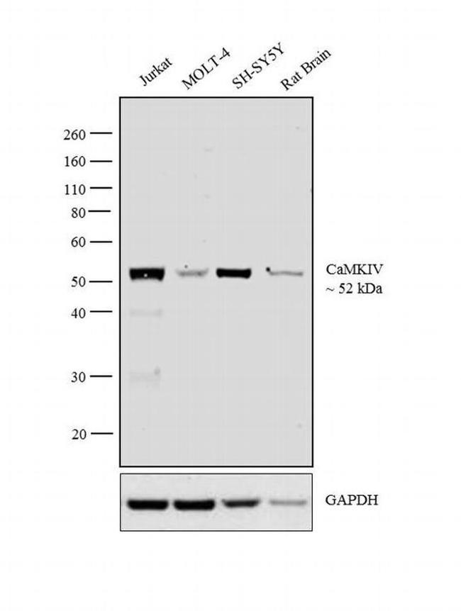 CaMKIV Antibody in Western Blot (WB)