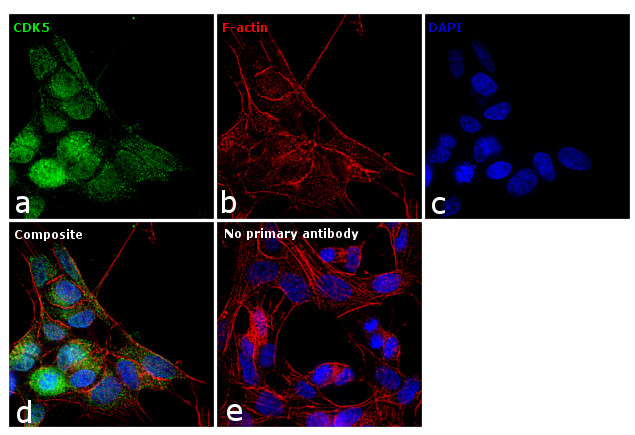 CDK5 Antibody in Immunocytochemistry (ICC/IF)