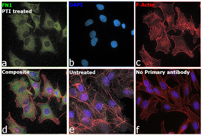 Fibronectin Antibody in Immunocytochemistry (ICC/IF)