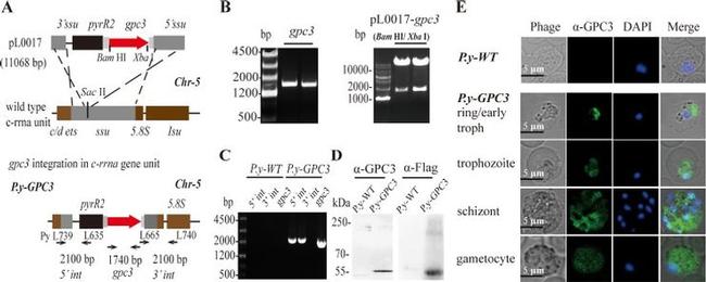 Glypican 3 Antibody in Immunocytochemistry (ICC/IF)