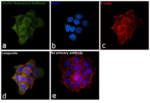 CD104 Antibody in Immunocytochemistry (ICC/IF)