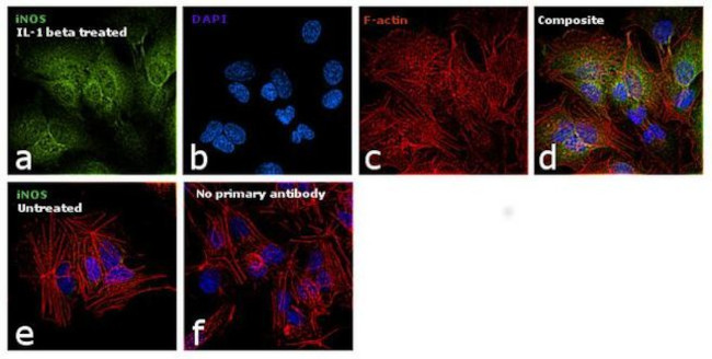 iNOS Antibody in Immunocytochemistry (ICC/IF)