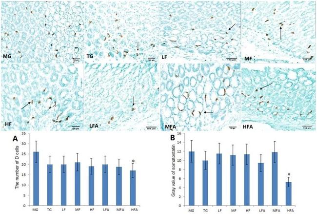 Somatostatin Antibody in Immunohistochemistry (Paraffin) (IHC (P))