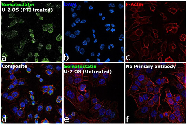 Somatostatin Antibody in Immunocytochemistry (ICC/IF)