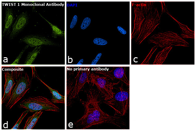 TWIST1 Antibody in Immunocytochemistry (ICC/IF)