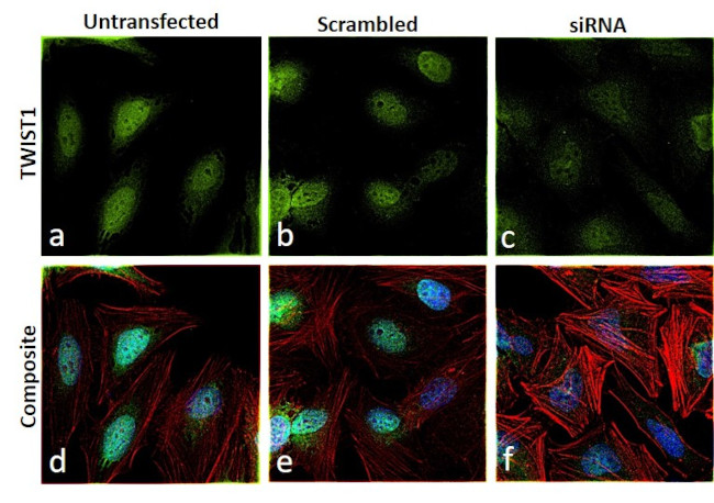 TWIST1 Antibody