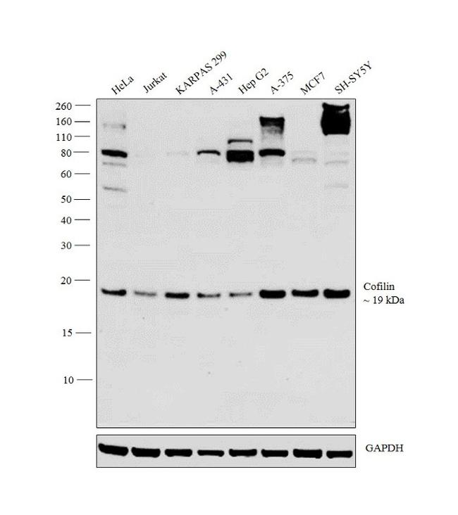 Cofilin Antibody in Western Blot (WB)