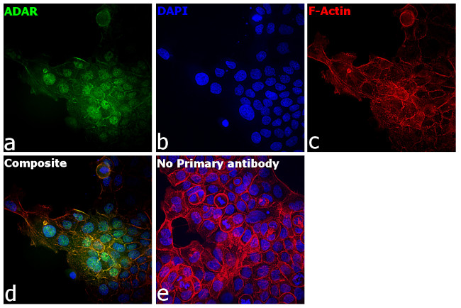 ADAR Antibody in Immunocytochemistry (ICC/IF)