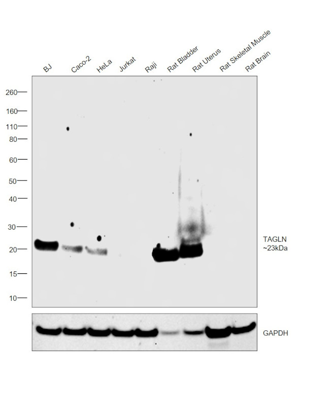 TAGLN Antibody