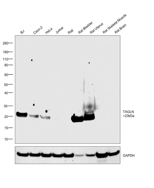 TAGLN Antibody in Western Blot (WB)