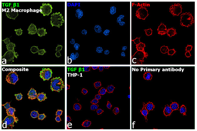 TGF beta-1 Antibody