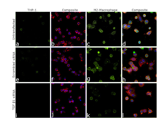 TGF beta-1 Antibody in Immunocytochemistry (ICC/IF)