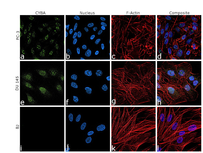 CYBA Antibody in Immunocytochemistry (ICC/IF)