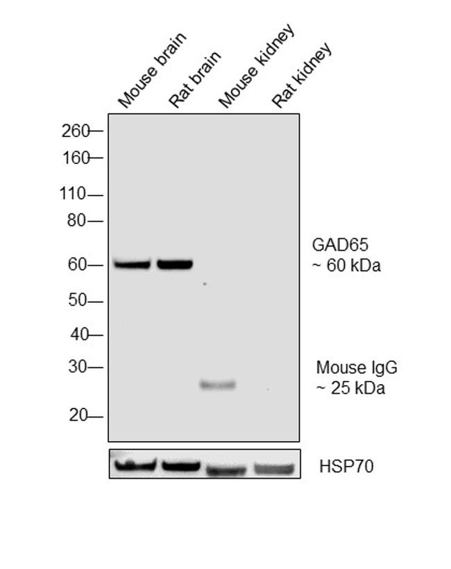 GAD65 Antibody in Western Blot (WB)