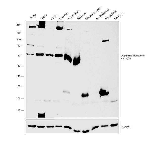 Dopamine Transporter Antibody in Western Blot (WB)