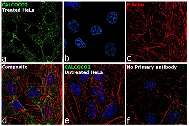 CALCOCO2 Antibody