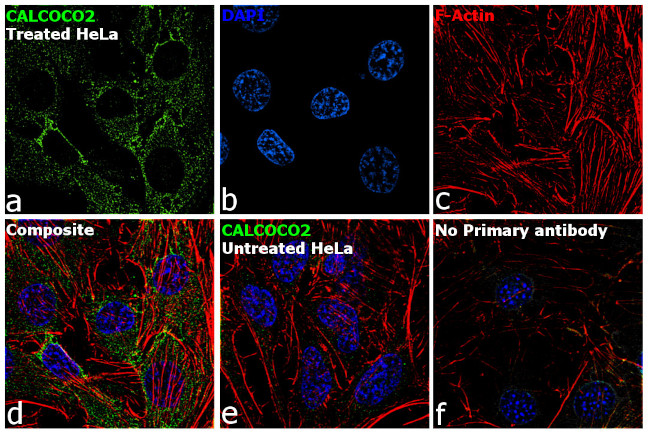 CALCOCO2 Antibody in Immunocytochemistry (ICC/IF)