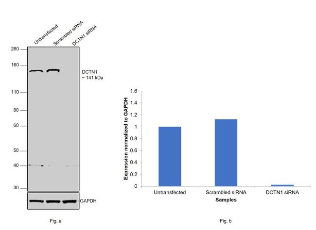 Dynactin 1 Antibody in Western Blot (WB)