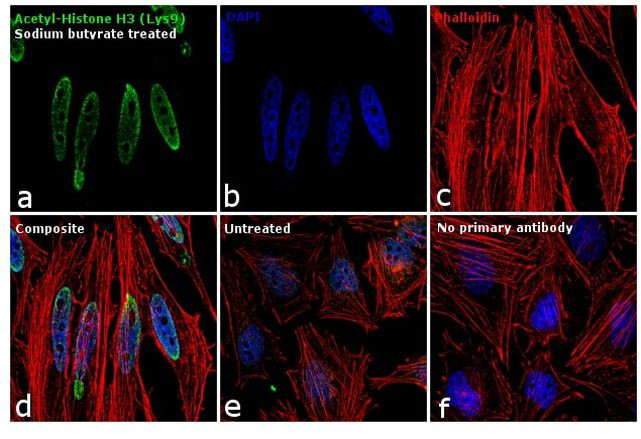 H3K9ac Antibody in Immunocytochemistry (ICC/IF)