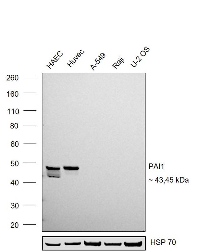 PAI1 Antibody in Western Blot (WB)